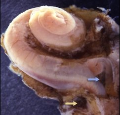 Cochlea Dissected