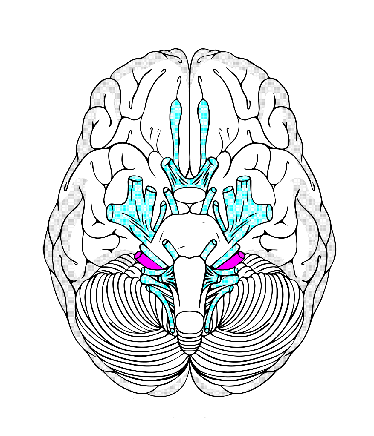 Cranial Nerve VIII (auditory nerve in red)