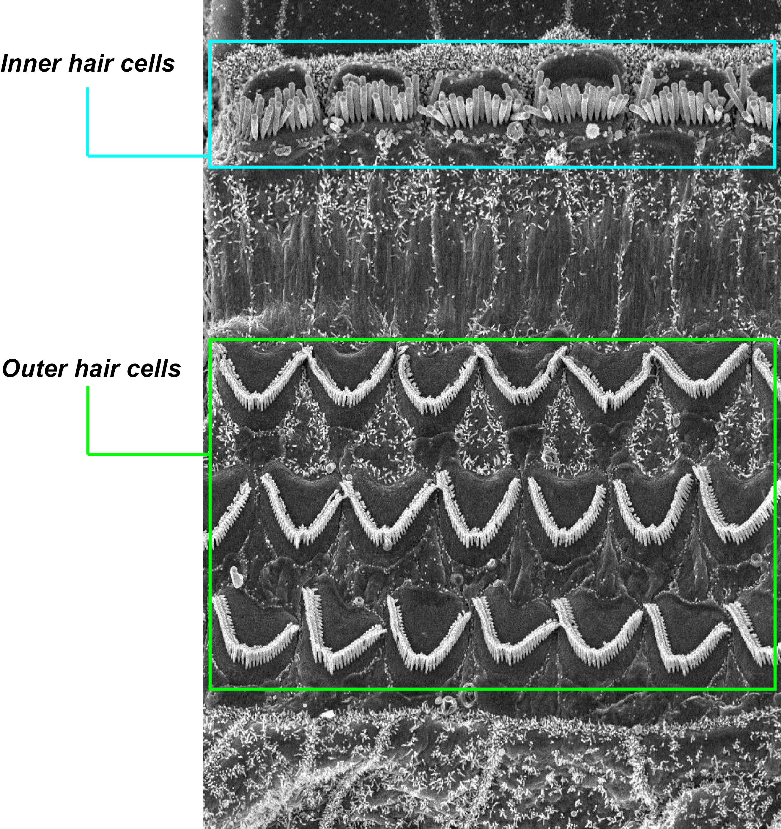 Inner and Outer Hair Cells