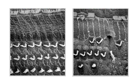 Comparison Normal Hair Cell vs. Damaged Hair Cell